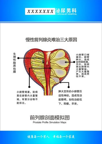 753海报印制展板写真喷绘71医院院内医生科室图谱前列腺剖图挂图