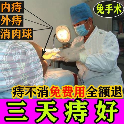 痔根断片德国进口白白痔哥消肉球特效肛门瘙痒屁眼断痔膏混合痔