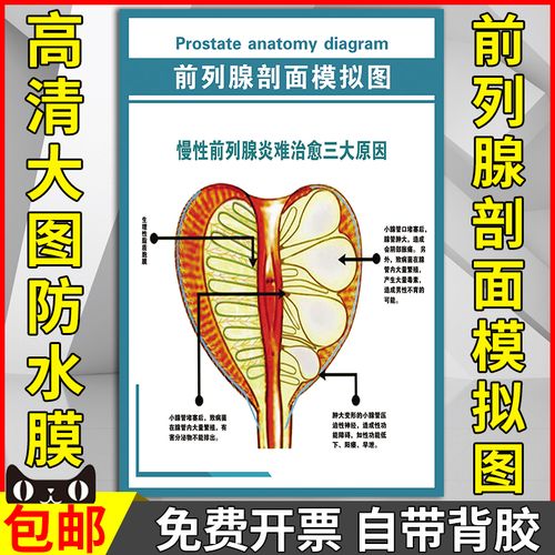 前列腺剖面模拟图墙贴男性生殖器官解剖图医院人体器官结构图海报