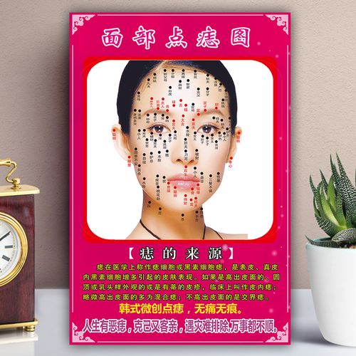 新点痣挂画男女面痣穴位图美容祛痣祛斑取痣除痣广告宣传面相墙贴