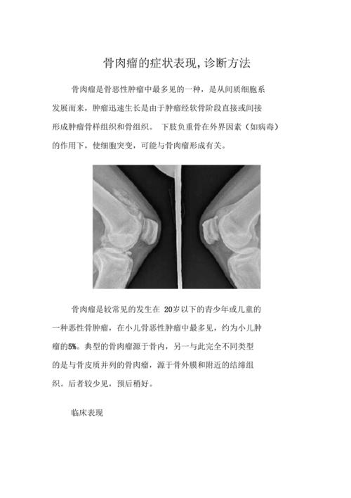 骨肉瘤的症状表现诊断方法
