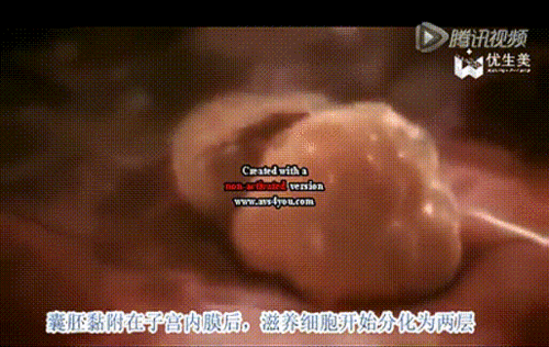 不是每个子宫腔都张开臂膀拥抱胚胎的