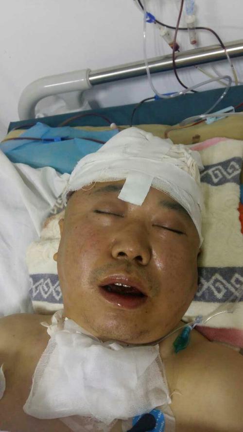 救救我的父亲——我的父亲因脑出血昏迷,目前在icu