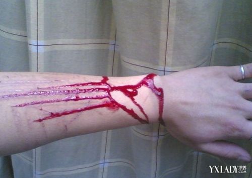 【图】手臂流血的照片大盘点 4大步骤教你快速止血