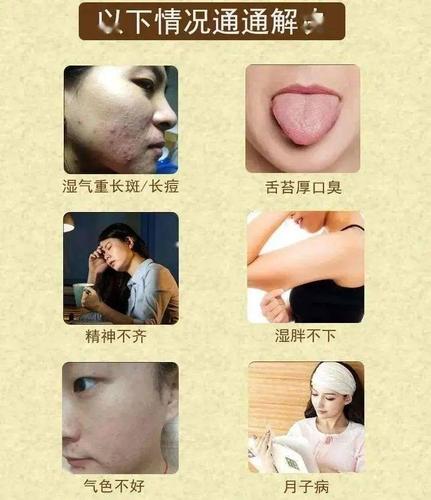 湿气重的人身上这2个部位会变大再忙也要看看