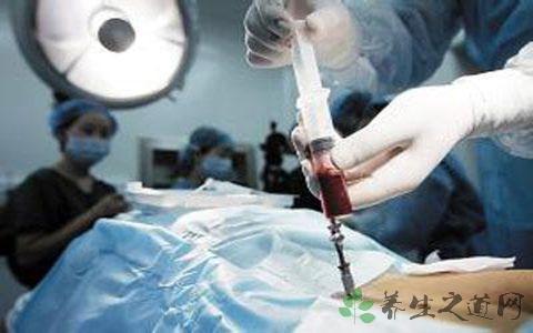 2,骨髓移植与干细胞移植有什么区别