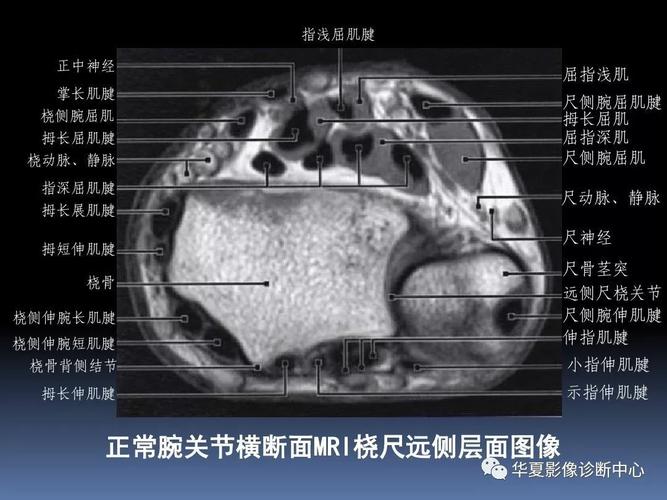 结构越小越困难腕关节的解剖几种常见病的诊断