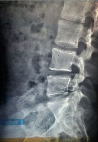 尾巴根疼.是哪里的问题?