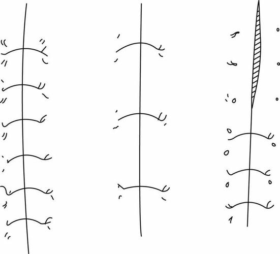 换药/拆线的基本原则,技术及注意事项