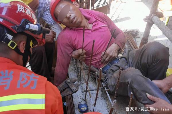 一名在高空作业的建筑工人不慎从高空坠落,腹部被固定在地面的钢筋