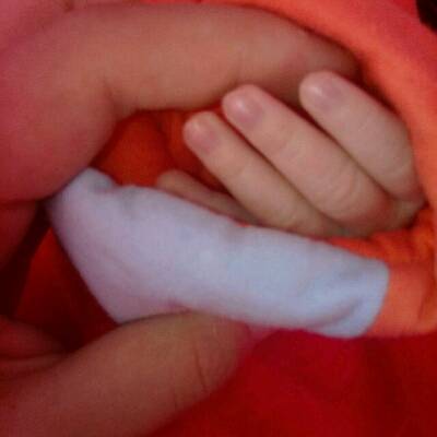 新生儿25天指甲盖这种颜色正常吗,(附有图片)有点紫色