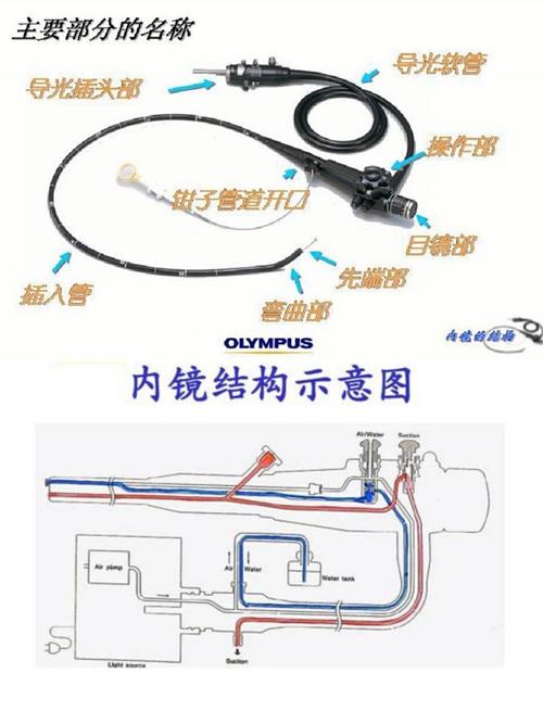 其它 规范管理 内镜先行 写美篇  软式内镜是镜身柔软,可弯曲的一类