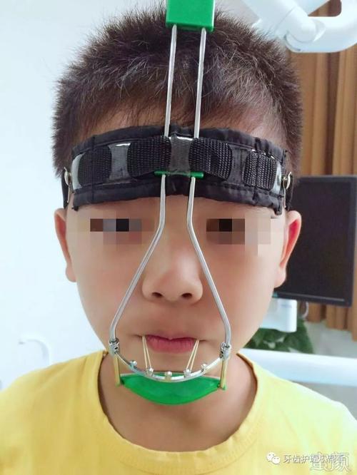 小朋友的牙齿为什么会地包天?