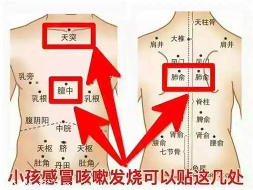 禾风记足贴小孩感冒发烧贴得有效果吗