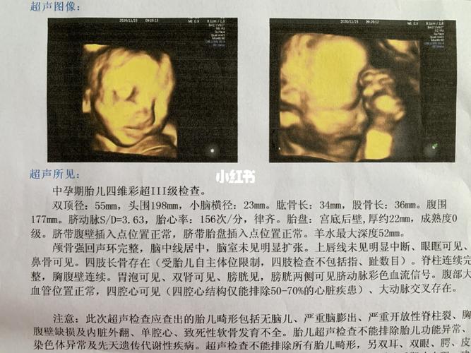 四维彩超_女宝_四维彩超_男宝女宝_母婴_孕产经验