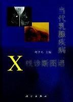 《当代乳腺疾病x线诊断图谱》一书是上海东方乳腺疾病医院集15年来