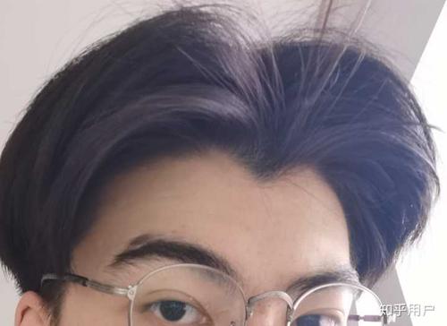 有美人尖,不想留刘海了,刘海剪短点都会翘,又油,中分又分不开,可是