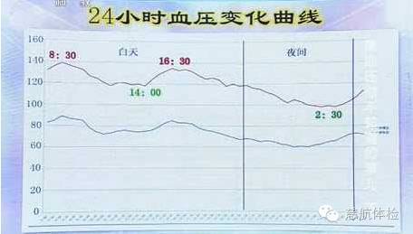 医院的血压计是什么牌子国产电子血压计十大名牌