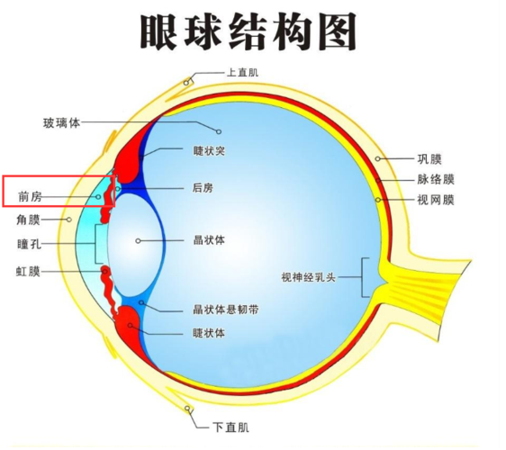 这些因素可能会导致眼压在短时间内骤然升高,诱发闭角型青光眼