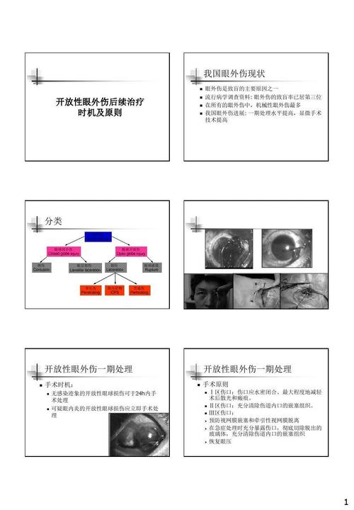 显微手术技术提高 分类 眼外伤 ocular trauma眼球闭合伤 closed