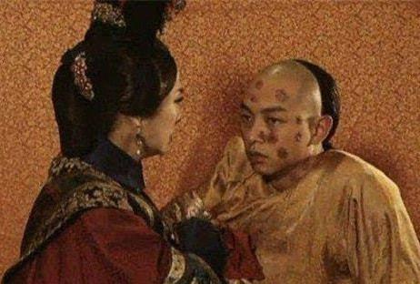 41年前,天花被人类消除,这个让数亿人死亡的病魔是怎样被根除的