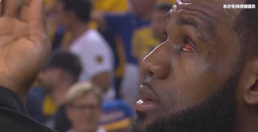 首战被戳伤的眼还在通红,而今天詹姆斯再次被格林打头