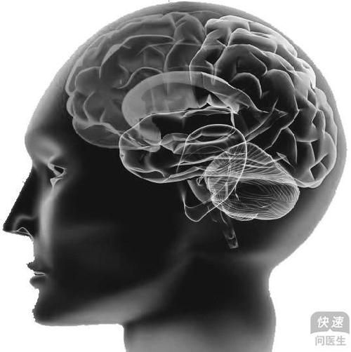 脑萎缩是怎么回事 带你认识脑萎缩四大原因