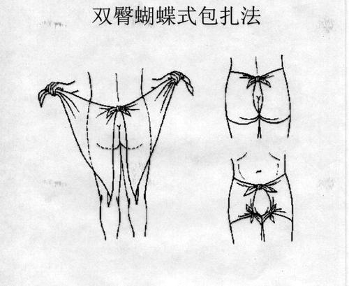 外科学图片集锦:双蝴蝶式包扎法