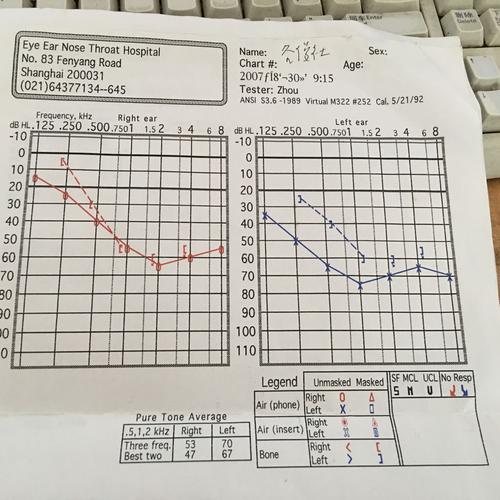 帮我看一下这份听力报告 哪只耳朵更聋 聋到啥程度 分贝区间是多少