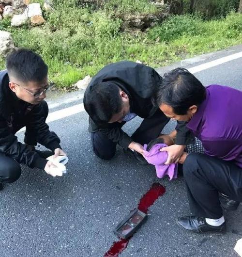 天啦!昨天216线一摩托车摔倒在地,驾驶员头部受伤流血几米长.