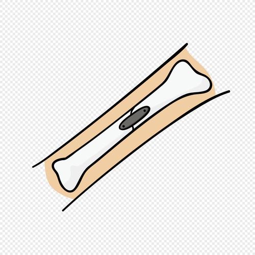 qq空间 新浪微博  花瓣 举报 标签: 包扎受伤手术手绘矢量骨折手绘