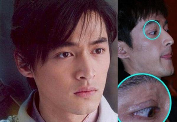 胡歌车祸前后对比照曝光 揭秘车祸诡异内幕