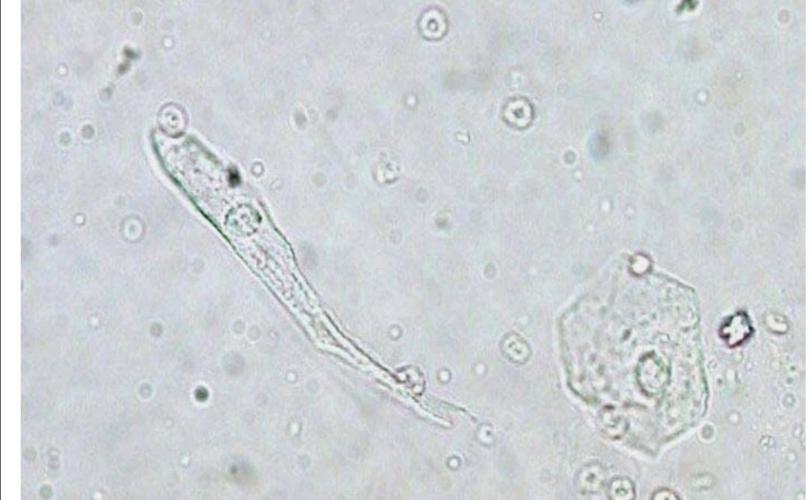 中层移行上皮细胞,呈柱状或尾形,细胞核呈圆形或卵圆形,细胞质丰富.