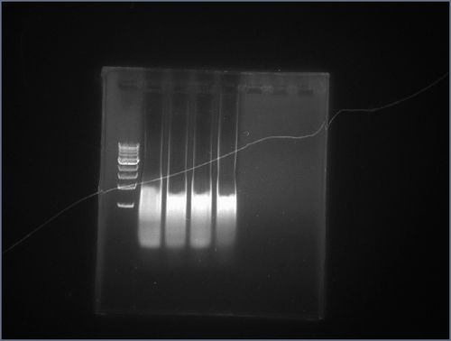 请高手帮忙分析下dna跑胶图,分析下为什么出现这种情况?