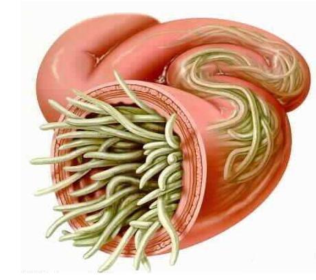 宝宝肚子里有没有"蛔虫",从这5点就能看出来,家长别大意!