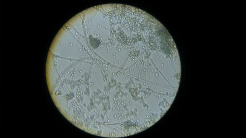 利用放大镜肉眼观察霉菌外部形态