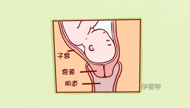 【组图】关于开宫口,临产前你必须知道