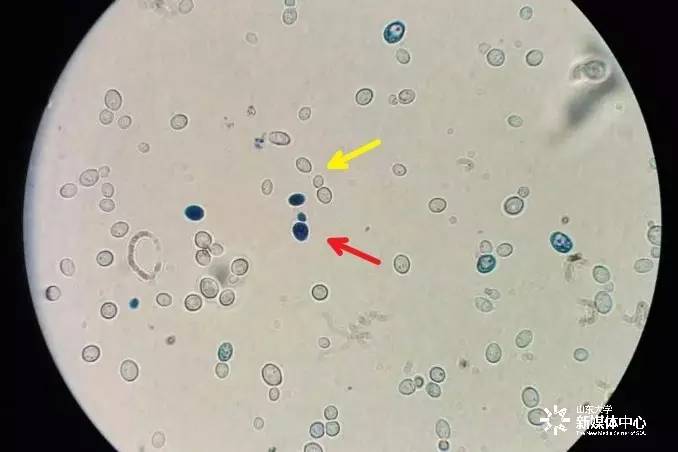 图中蓝色部分为显微镜下的酵母菌