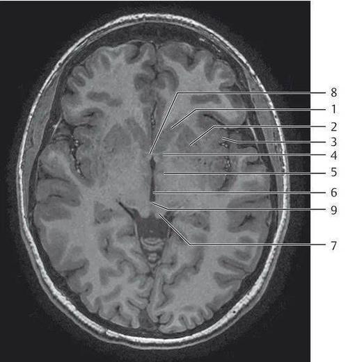 334.头部磁共振解剖