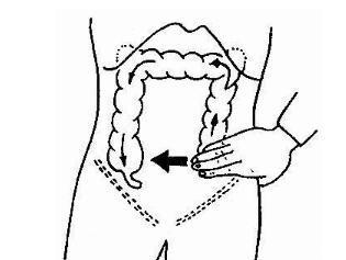 心口窝疼,如果是持续性伴大汗,且没有按压疼痛,就是按压这个地方不疼