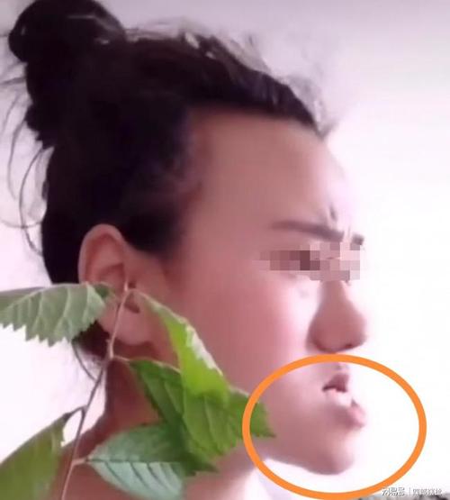 女子整容把下巴整成了超级地包天现身说法什么都是原装的好