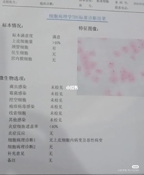 hpv感染过程_hpv_妇科_私处_癌症_医疗健康_医疗健康