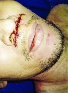 县公安局签订协议,委托中国政法大学法庭鉴定研究所做二次尸检鉴定