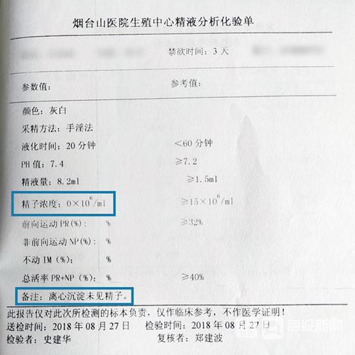 接受治疗前王先生的精液分析化验单
