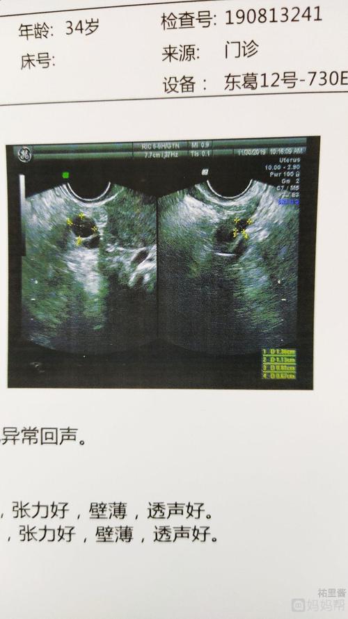 单绒双羊双绒双羊有哪位宝妈会看吗