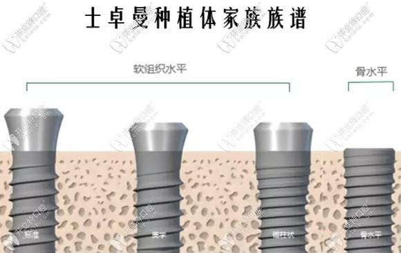 种植界的大神-瑞士士卓曼(iti)种植牙多少钱一颗,你想知道吗