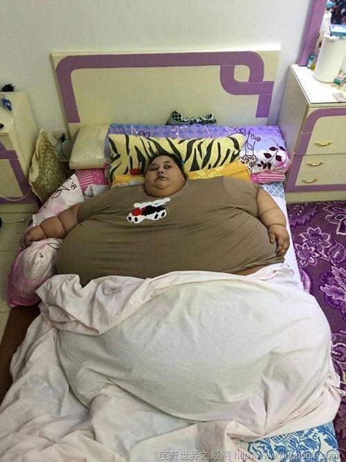 世界上最胖的女人埃文艾哈迈德体重990斤