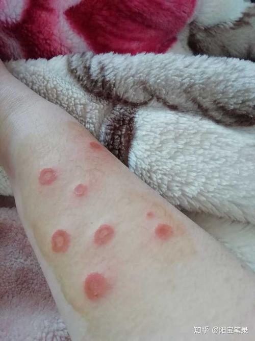 猫睡在人的床上可能会导致哪些健康问题