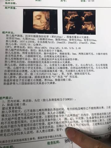 怀孕30周 5天,大家帮我看看是男孩还是女孩