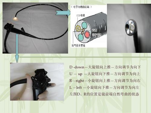 胃镜初学体会ppt